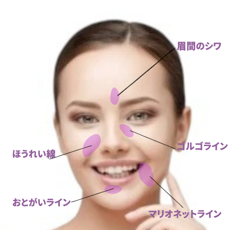 国分寺で肌（しわ・たるみ）の改善｜ヒアルロン酸・ボトックス